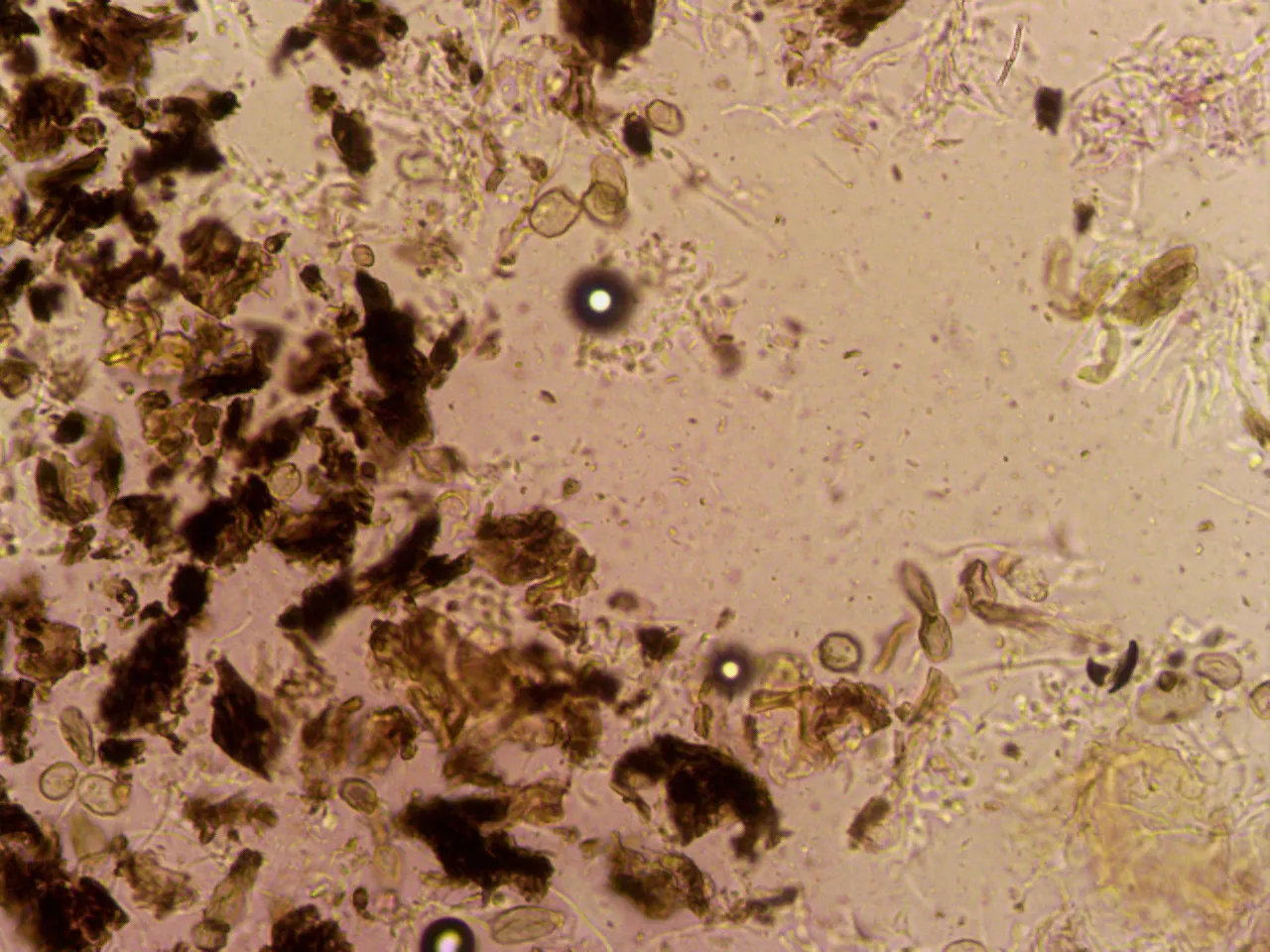 Microscopía de Pyrenula papilligera - 10 - Talo KOH